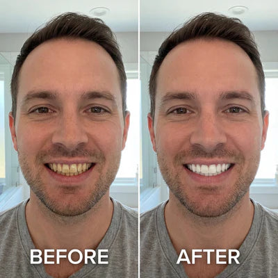 Rayhollow™ Tooth Polish - Instant Clean Smile