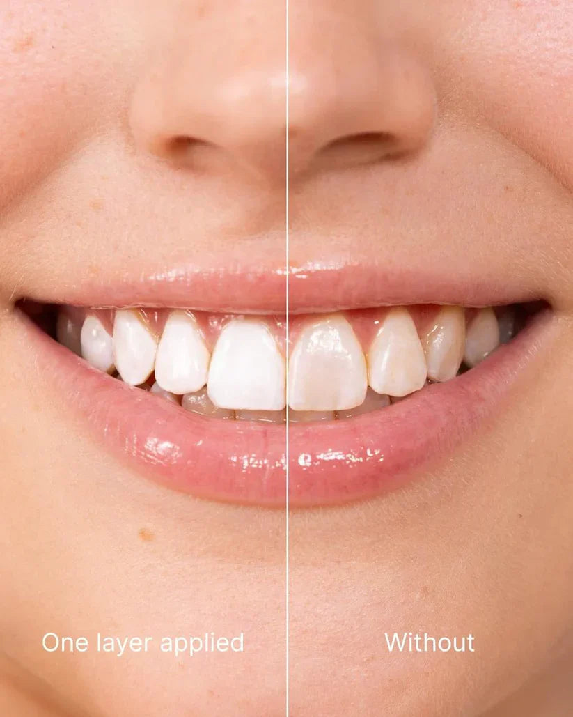 Rayhollow™ Tooth Polish - Instant Clean Smile